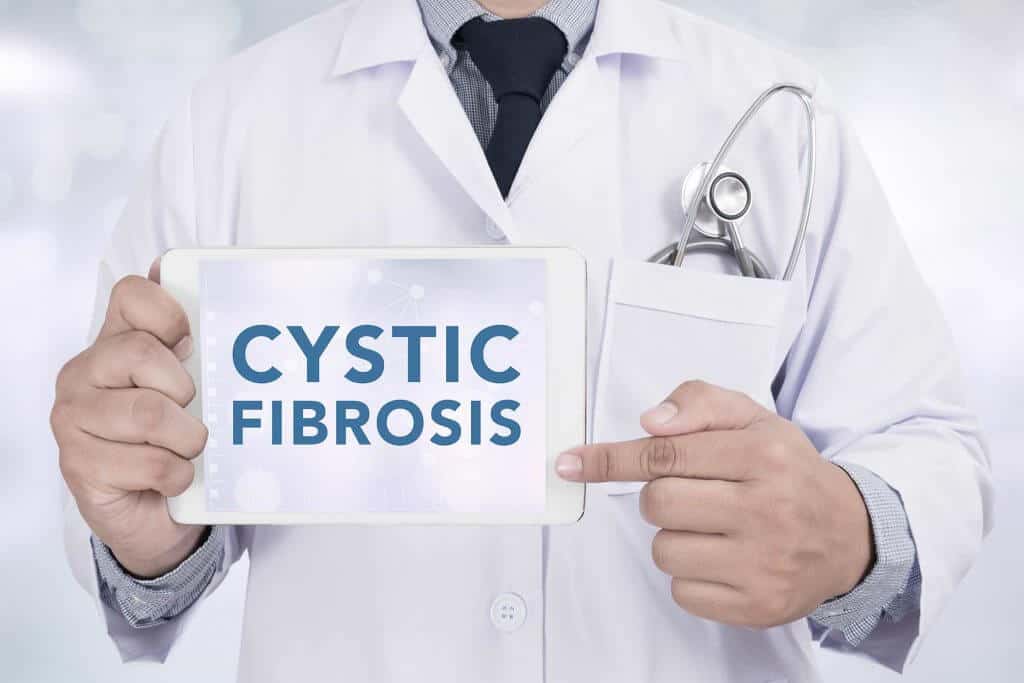 Sistik Fibrosis