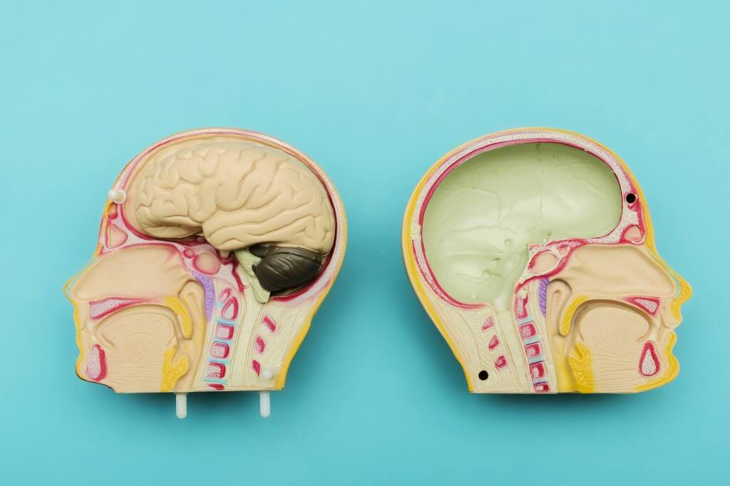 Meningitis Cerebrospinal