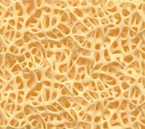 Fibrodisplasia Osifikan Progresif (Fibrodysplasia ossificans progressiva) - Punca, Simptom, Diagnosis, Komplikasi dan Rawatan