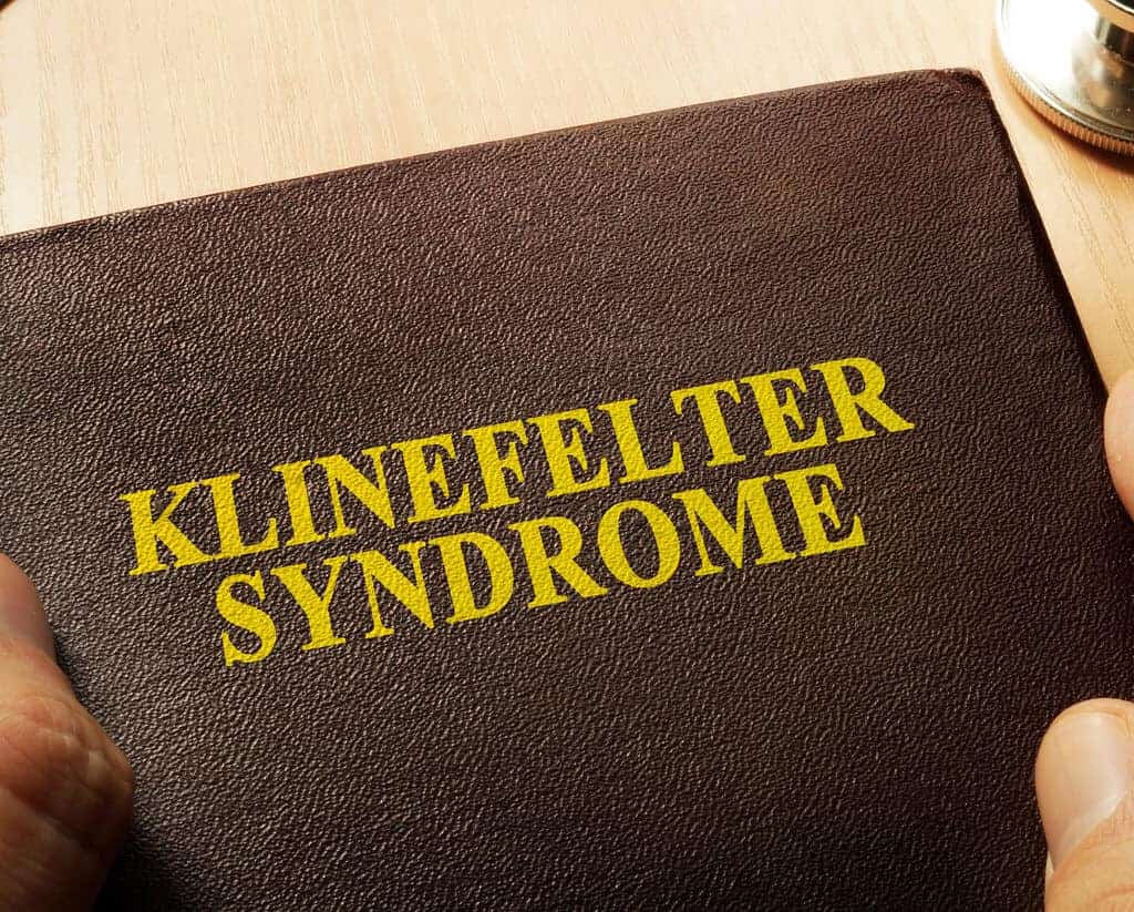 sindrom klinefelter