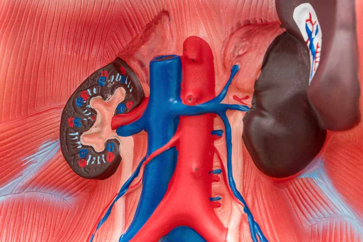 stenosis arteri buah pinggang