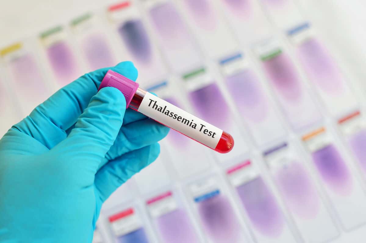 Simptom thalassemia
