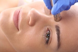 Microdermabrasion - Bagaimana ia berfungsi, Kelebihan dan Prosedur