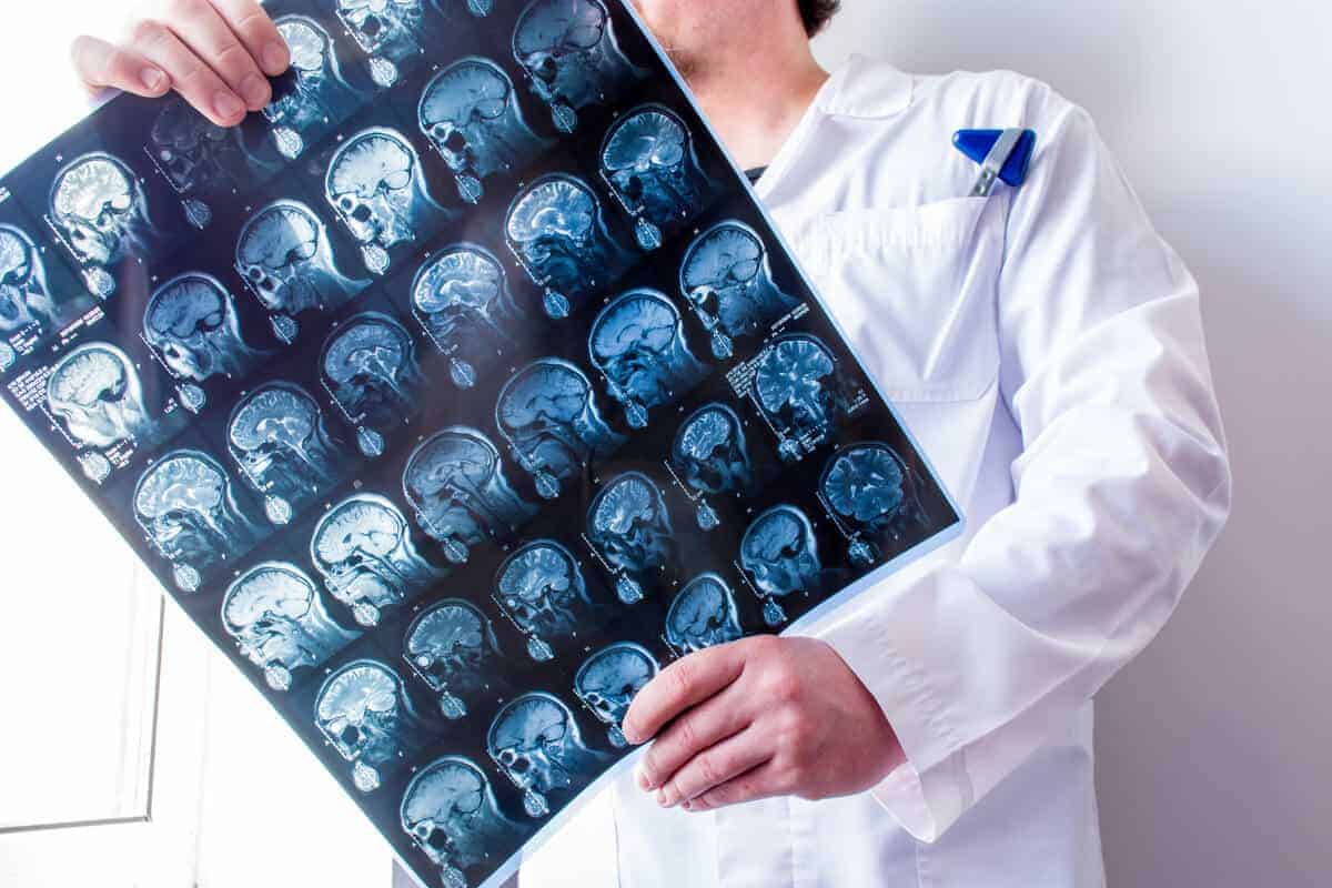 encephalomalacia